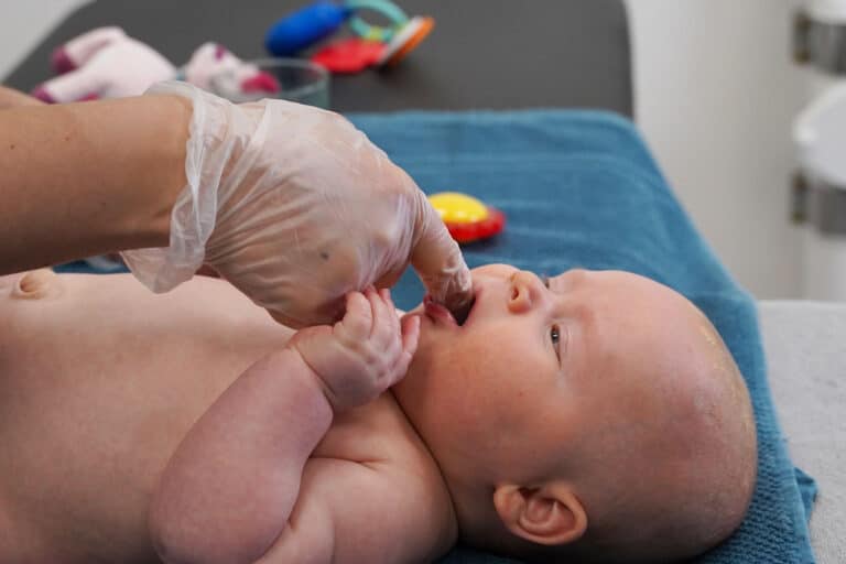 Vauvan kireä kielijänne